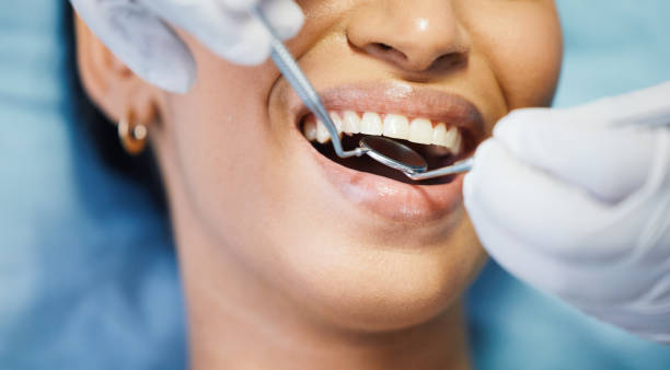 Best Emergency Treatment for Dental Infections or Abscesses in Pittsfield, MA